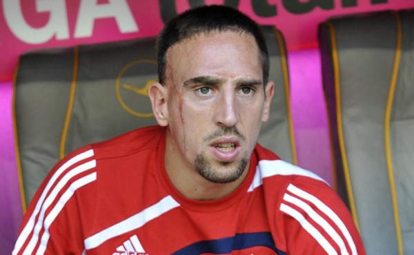 Ribéry demanda a CNN por derechos de imagen