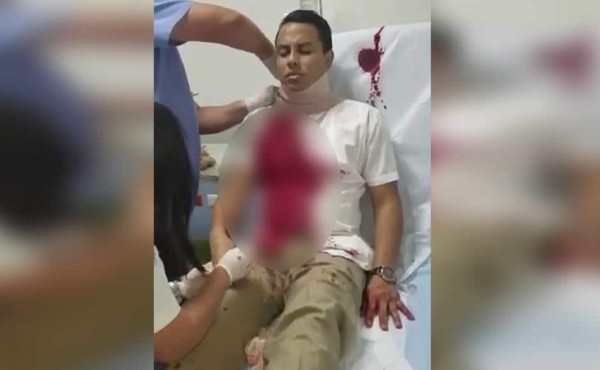 Video: El día que Igor Padilla salvó de morir a otro periodista en San Pedro Sula