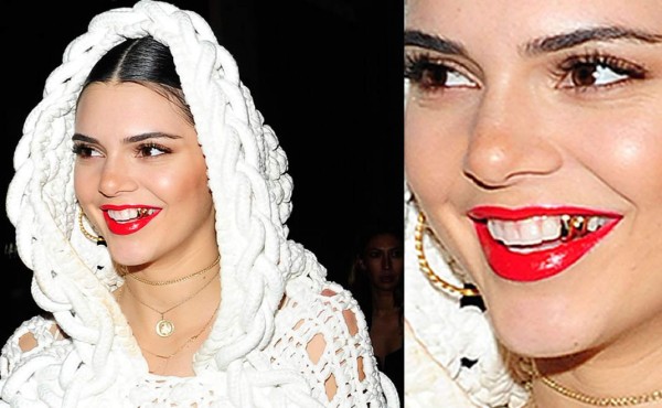 Kendall Jenner y sus dientes de oro