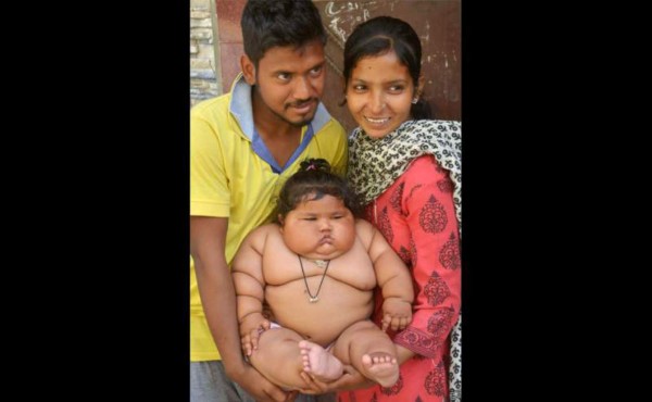Bebé conmociona al mundo por su sobrepeso