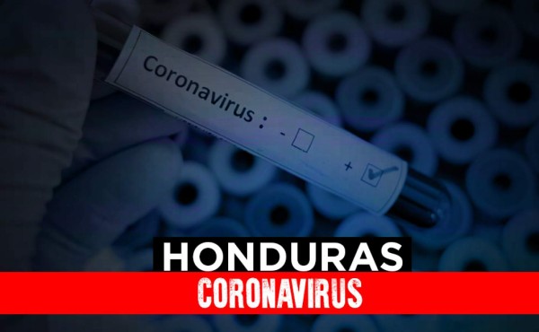 Honduras: 472 personas contagiadas por COVID-19 y 15 recuperadas
