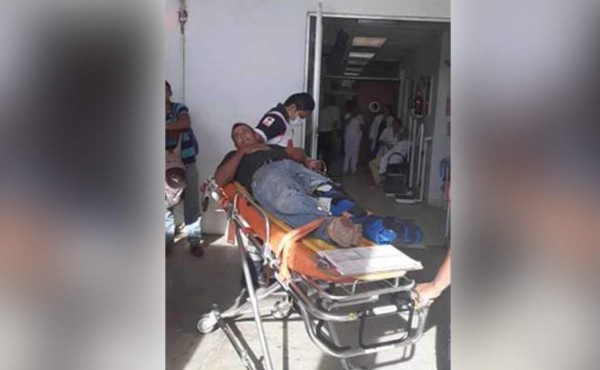 Migrante hondureño pierde un pie tras caer de 'La Bestia' en México