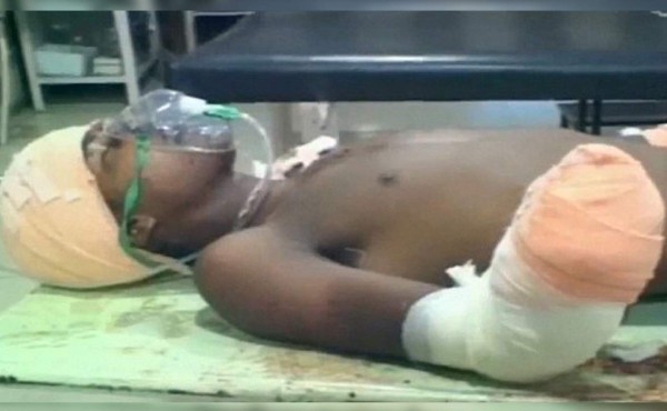 Padre le corta las manos al supuesto violador de su bebé en India