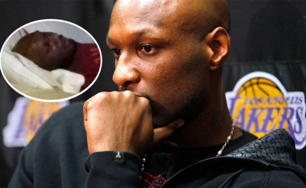 Lamar Odom y su desgarradora confesión: 'Gasté alrededor de 100 millones en droga'