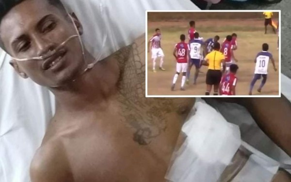 Futbolista nicaragüense se fractura varias costillas y se perfora un pulmón en accidentada jugada