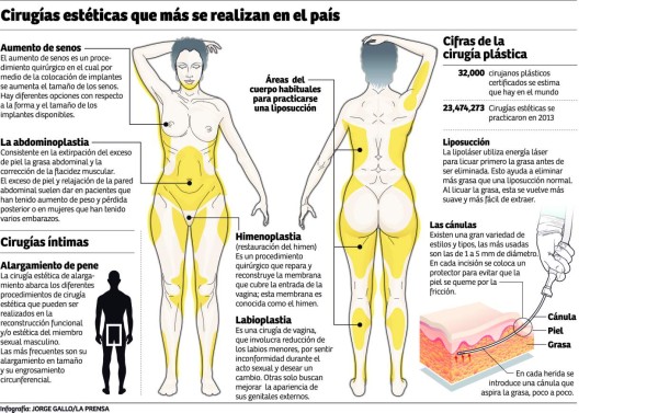 Liposucciones y aumento de senos, las cirugías de más auge en Honduras
