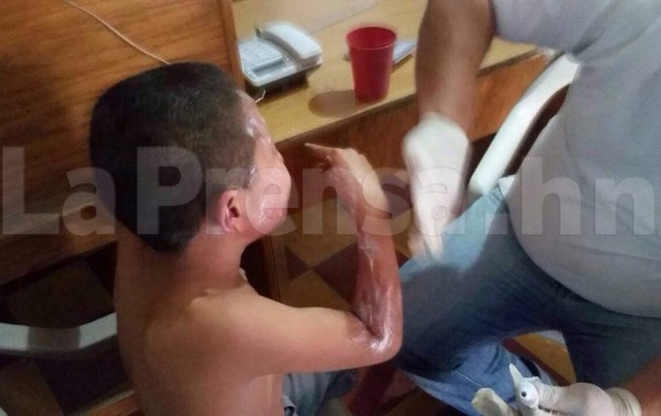 Niño de diez años se quema con pólvora ﻿en Copán 