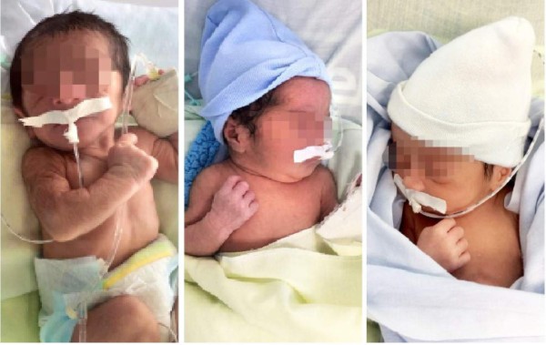 Fuera de peligro los trillizos que nacieron en el hospital Mario Rivas