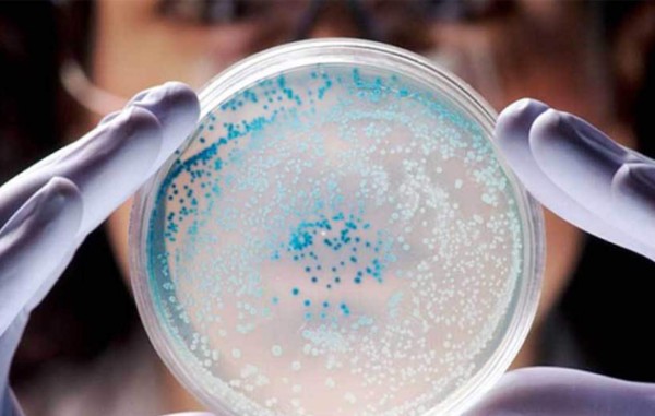 Muere una tercera persona en EUA por bacteria comecarne