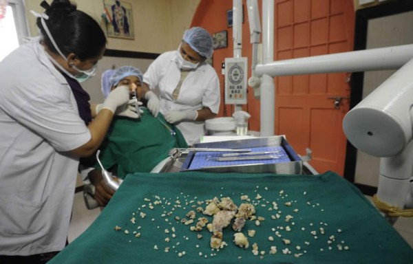 Video: Extraen 232 dientes a un joven en la India