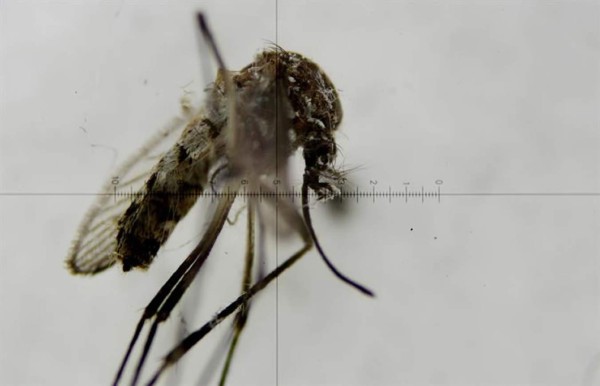 Brasil distribuirá 3,5 millones de exámenes para diagnosticar el zika
