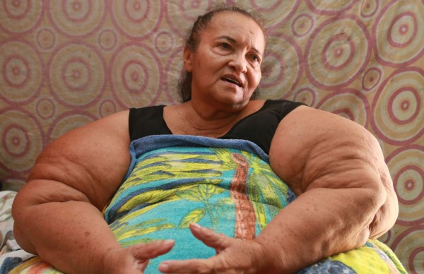 Hondureña es prisionera de sus 600 libras de peso