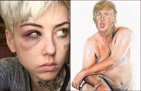 Artista que pintó a Trump desnudo denuncia agresión