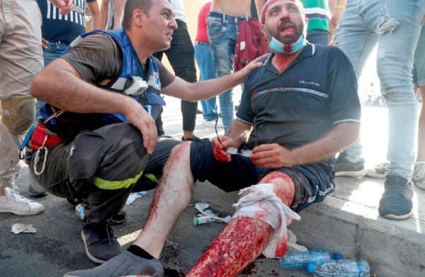 Beirut (Lebanon), 08/08/2020.- An injured Lebanese anti-government protester sits on the pavement during clashes with riot police at a protest in Beirut, Lebanon, 08 August 2020. People gathered for the so-called 'the Saturday of the hanging ropes' to protest against the political leaders and calling on those responsible over the explosion to be held accountable. Lebanese Health Ministry on 07 August said at least 154 people were killed, and more than 5,000 injured in the Beirut blast that devastated the port area on 04 August and believed to have been caused by an estimated 2,750 tons of ammonium nitrate stored in a warehouse. (Protestas, Líbano) EFE/EPA/IBRAHIM DIRANI DAR AL MUSSAWIR