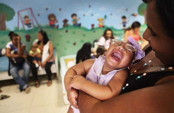 Nacen en San Pedro Sula seis bebés con microcefalia