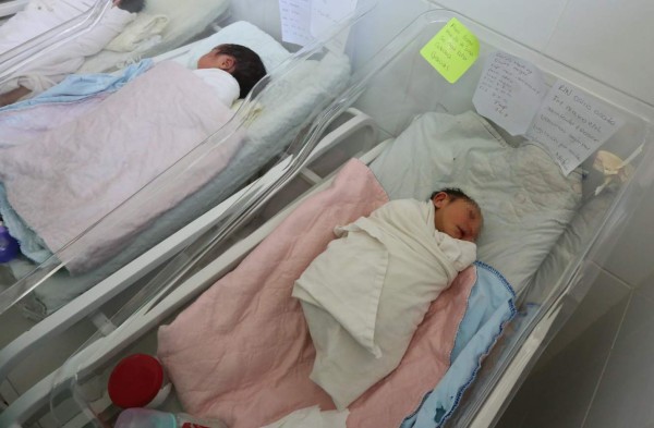 Suben a 74 los nacimientos de bebés con microcefalia en Honduras