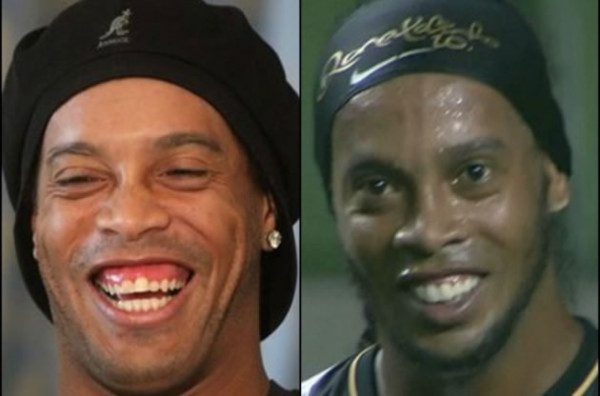 Vídeo: Ronaldinho estrena sonrisa al estilo 'Hollywood'