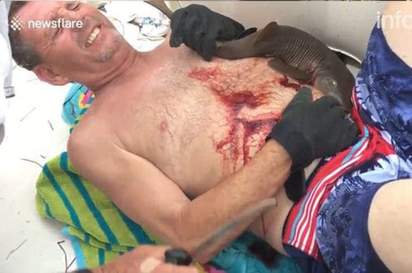 Hombre se mete al mar y sale con un tiburón adherido al abdomen