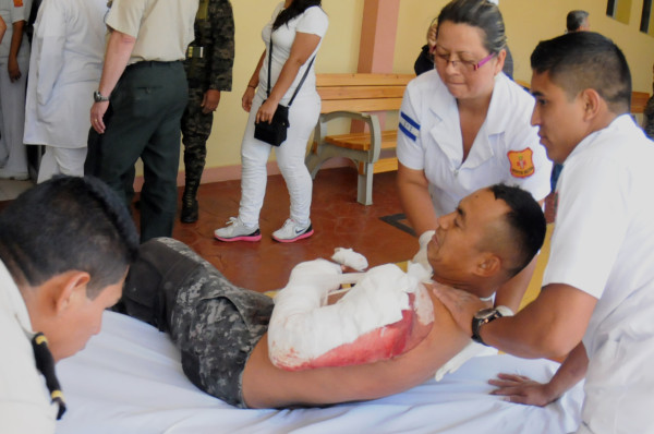 Heridos 5 policías en tiroteo con forajidos en Comayagua