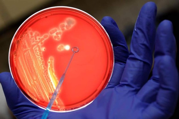 EEUU da a conocer la primera muerte por brote de 'E. coli' en lechugas