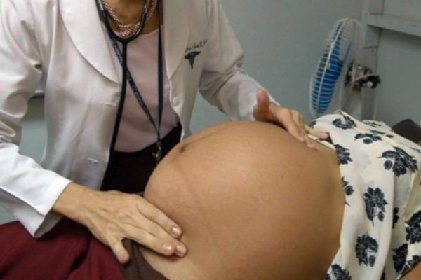 EUA: más de 150 embarazadas con posible infección de zika     