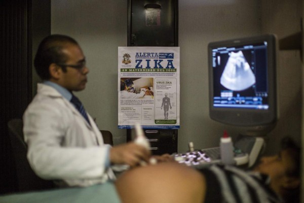 Investigan si bebé que nació con microcefalia fue por zika