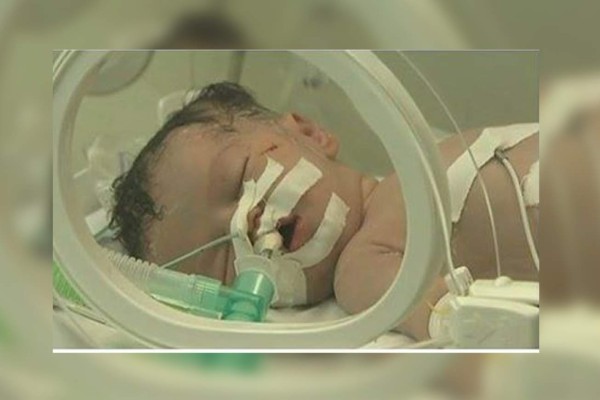 La niña que nació de una madre muerta en Gaza