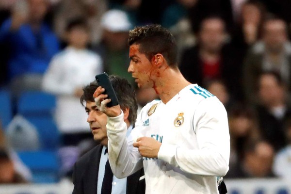 GRAF4120. MADRID, 21/01/2018.- El delantero portugués del Real Madrid, Cristiano Ronaldo, se mira en un teléfono móvil tras ser golpeado en la cara durante el partido de la vigésima jornada de Liga que disputan esta tarde ante el Deportivo en el estadio Santiago Bernabéu de Madrid. EFE/ Juan Carlos Hidalgo