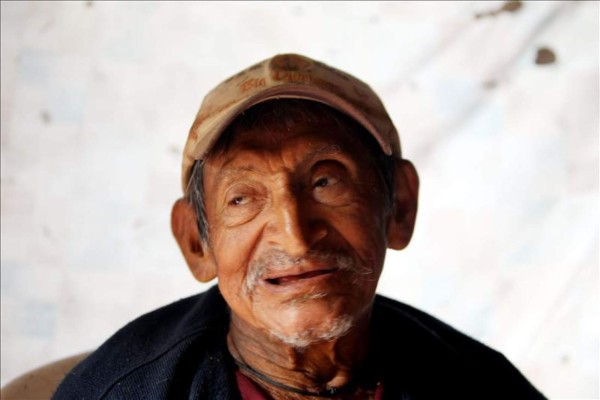 Hospitalizan al último cacique tolupán de 115 años de edad