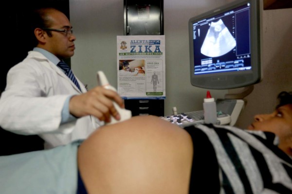 Alrededor de 60,000 embarazadas están expuestas al zika