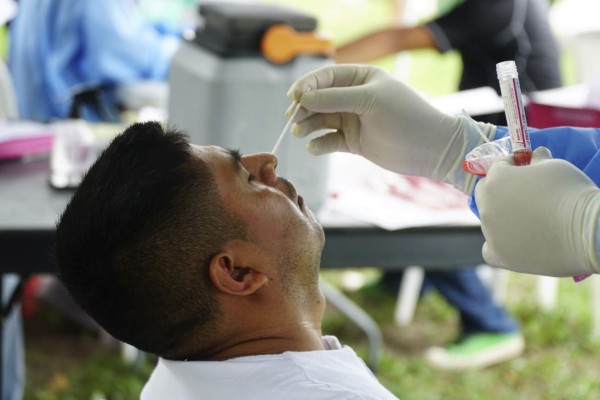 Secuelas del covid pueden durar hasta 60 días en los pacientes