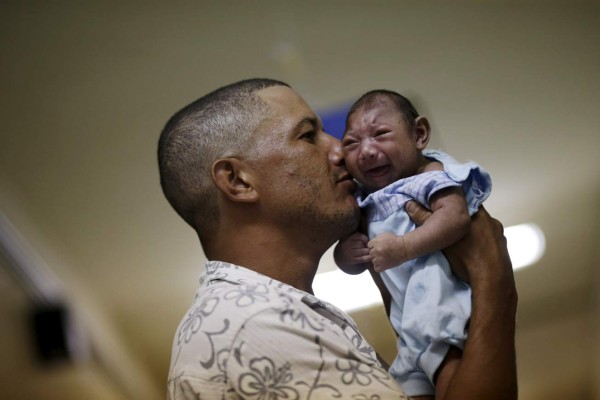 Las imágenes que muestran el daño de la microcefalia en bebés