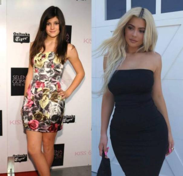 Al igual que su hermana Kim, Kylie se ha hecho de unos buenos implantes para promover su carrera, y con la ayuda de las redes ha sabido convertirse en la más exitosa de todas.