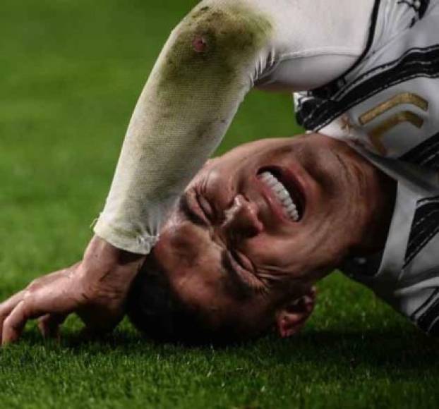 Cristiano Ronaldo se quejó del dolor que tenía en el brazo.