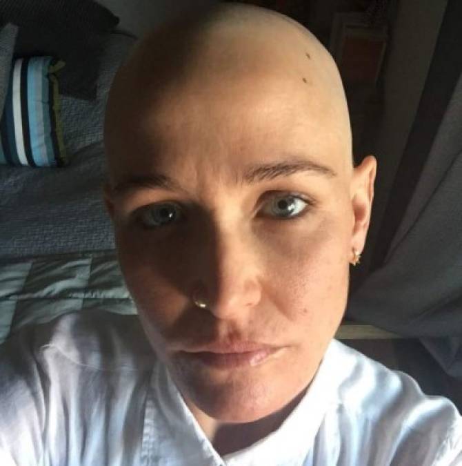 El año pasado, Butti, de 38 años, fue diagnosticada con cáncer de seno por segunda vez.<br/>