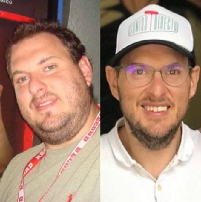 Al principio, Andrés pensó en recurrir al balón gástrico para lograr su cambio de imagen, pero una charla con su nutricionista lo hizo cambiar de parecer.