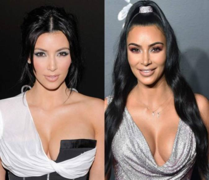 Recordemos que fue en 2007 cuando Kim Kardashian saltó a la fama por su video sexual con su novio en esa época Ray J.<br/><br/>Contando con esto es obvio que para 2009 la curvilínea ya había comenzado a hacerse sus mejoras.