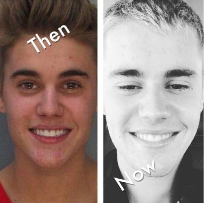 El cantante Justin Bieber ha compartido en su cuenta de Instagram una foto de su rostro antes y ahora.