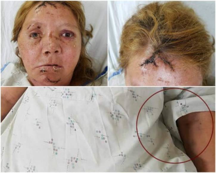 Como Irma de Jesús Muñoz (43) fue identificada una hondureña que recibió una paliza después de que su presunta amiga la atacara brutalmente.<br/>