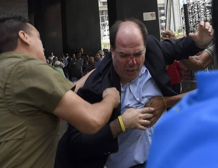 Julio Borges, jefe de la bancada parlamentaria de la coalición opositora Mesa de la Unidad Democrática fue agredido por chavistas.