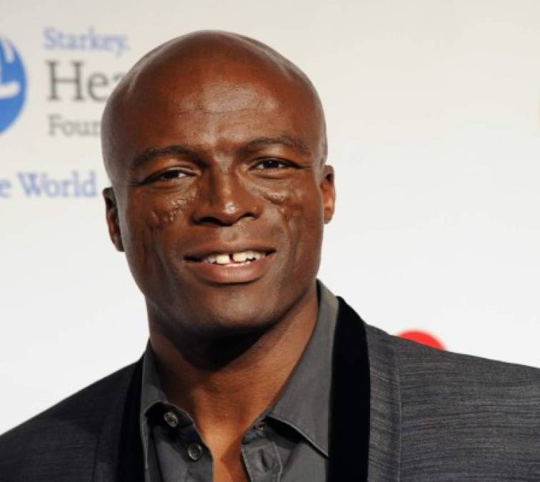 Seal: el cantante padece de Lupus Eritematoso Sistémico. Las cicatrices en su rostro son producto de esta enfermedad, en la cual el sistema inmunitario ataca al tejido conjuntivo.<br/><br/>El 10 de mayo se celebra el día mundial del Lupus, que busca mejorar los servicios de salud ofrecidos a los pacientes, aumentar la investigación sobre las causas y una cura para esta patología, mejorar el diagnóstico y el tratamiento, y mejores estudios epidemiológicos del impacto global de la enfermedad. <br/>