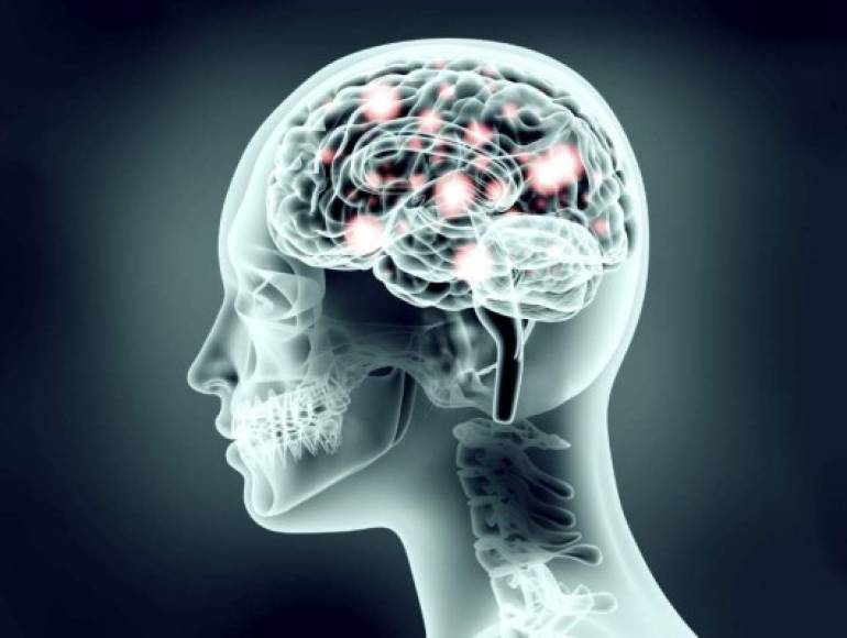 Daño cerebral<br/>El no dejar a nuestro cerebro descansar lo normal y forzarlo a permanecer en constante actividad aumenta el riesgo de un derrame cerebral.<br/><br/>