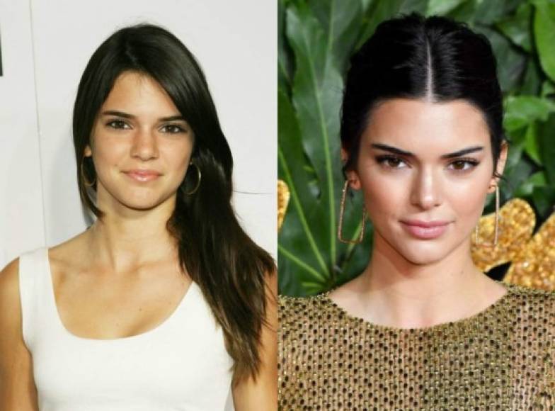 Kendall Jenner, con cirugías incluidas, parece igual que hace una década cuando tenía 13 años.