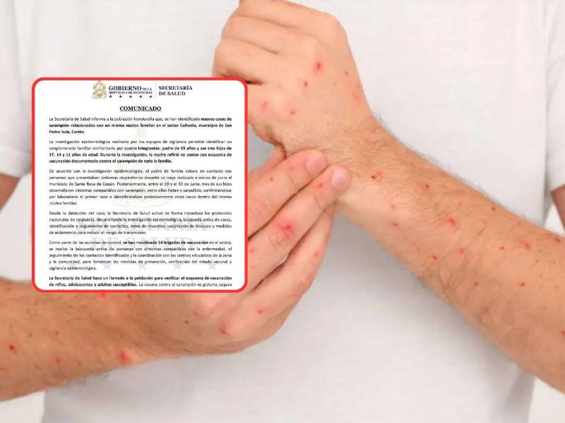 La Secretaría de Salud aseguró que continuará fortaleciendo la vigilancia epidemiológica y mantendrá activas las acciones de prevención y control para proteger a la población.