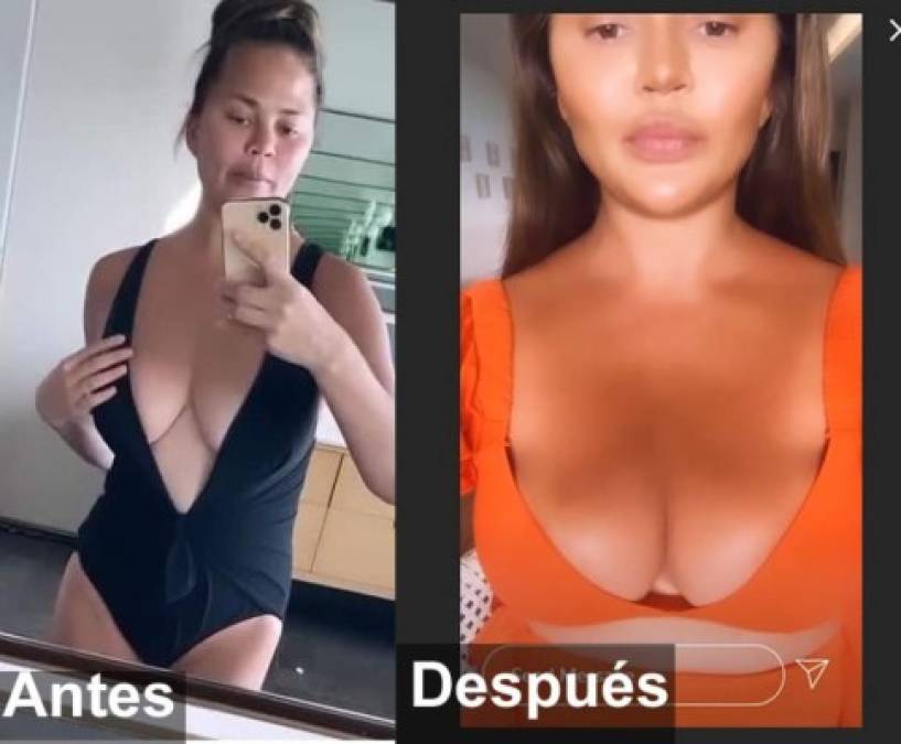 Chrissy dijo que algunos no creen que se haya quitado los implantes, ya que su busto natural es bastante pronunciado, por lo que bromeó diciendo que estaba dispuesta a sacarse un seno y mostrar las cicatrices.