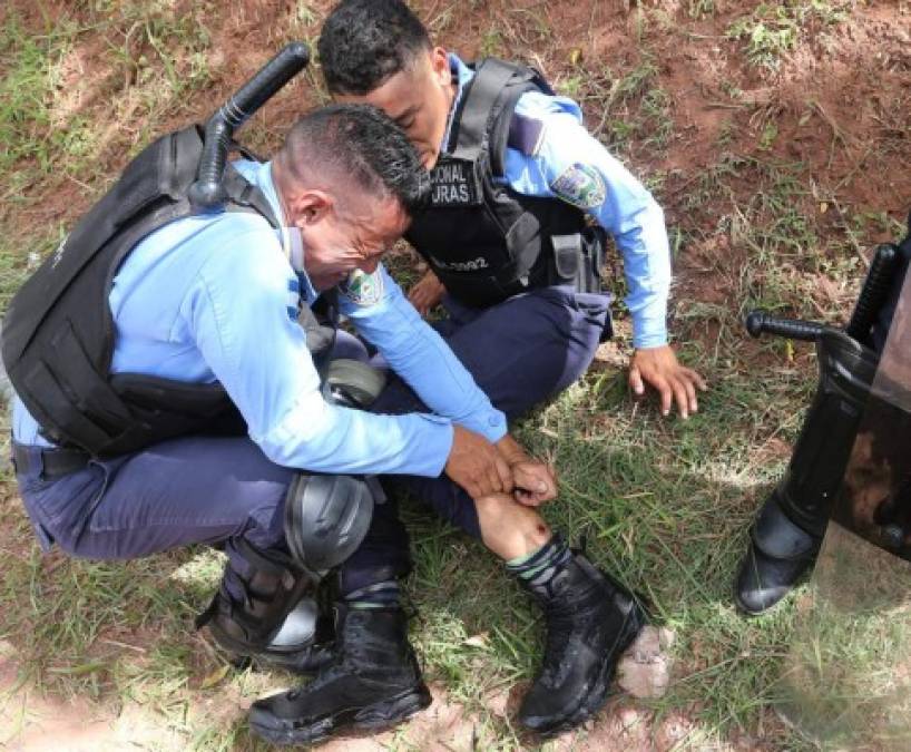 El Policía resultó herido de una de sus piernas.