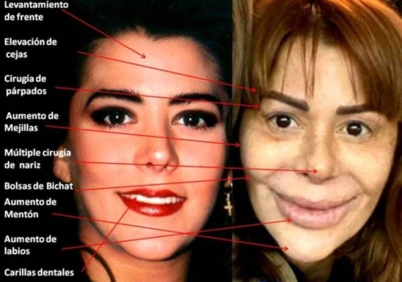 La roquera Alejandra Guzmán, creadora de 'eternamente bella', parece que su canción se va a cumplir en ella, puesto que se ha sometido a múltiples cirugías que han hecho irreconocible su cara.