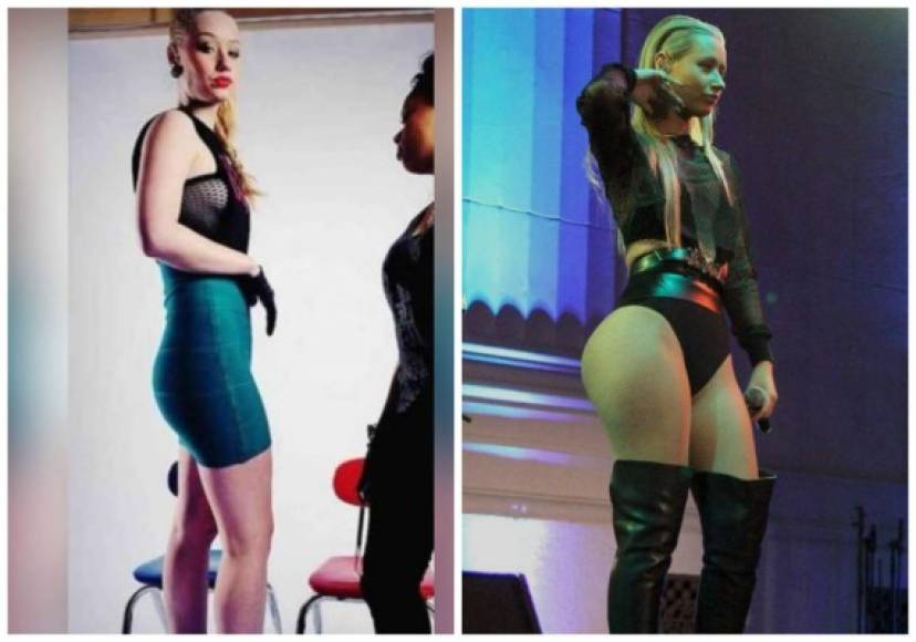 Iggy Azalea: la rapera australiana ha podido admitir sus implantes de senos, pero se niega a aceptar que su trasero no es para nada natural.