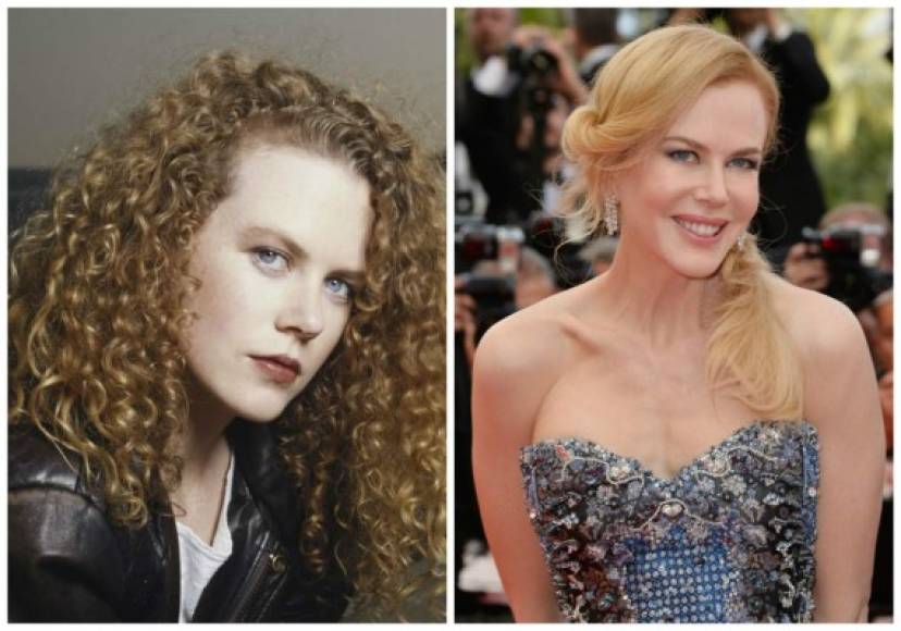 Medios aseguran que Nicole Kidman se operó la nariz.