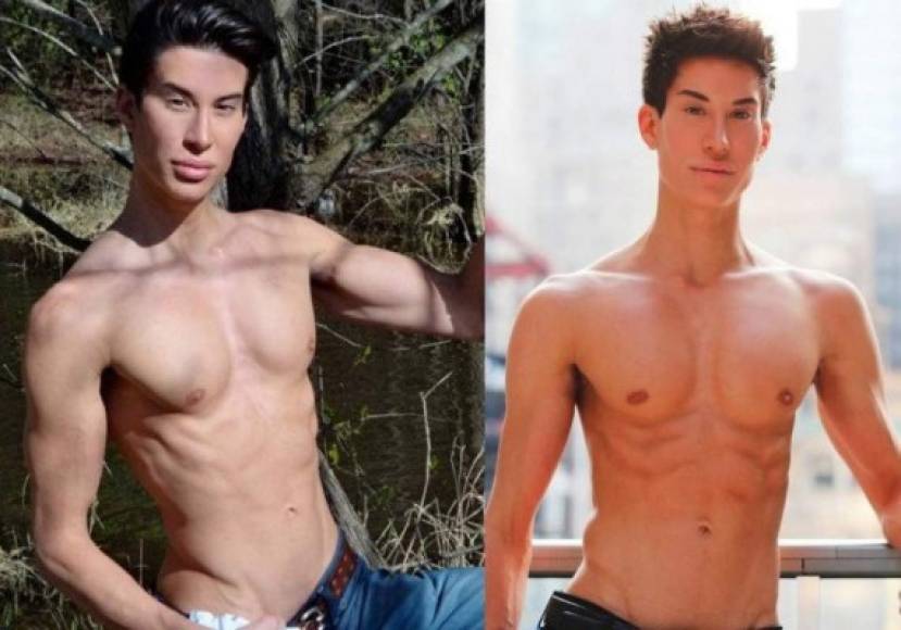 Justin Jedlica, el joven neoyorquino de tan solo 32 años, ya ha soportado más de cien intervenciones quirúrgicas y gastó 150 mil dólares para parecer a Ken.